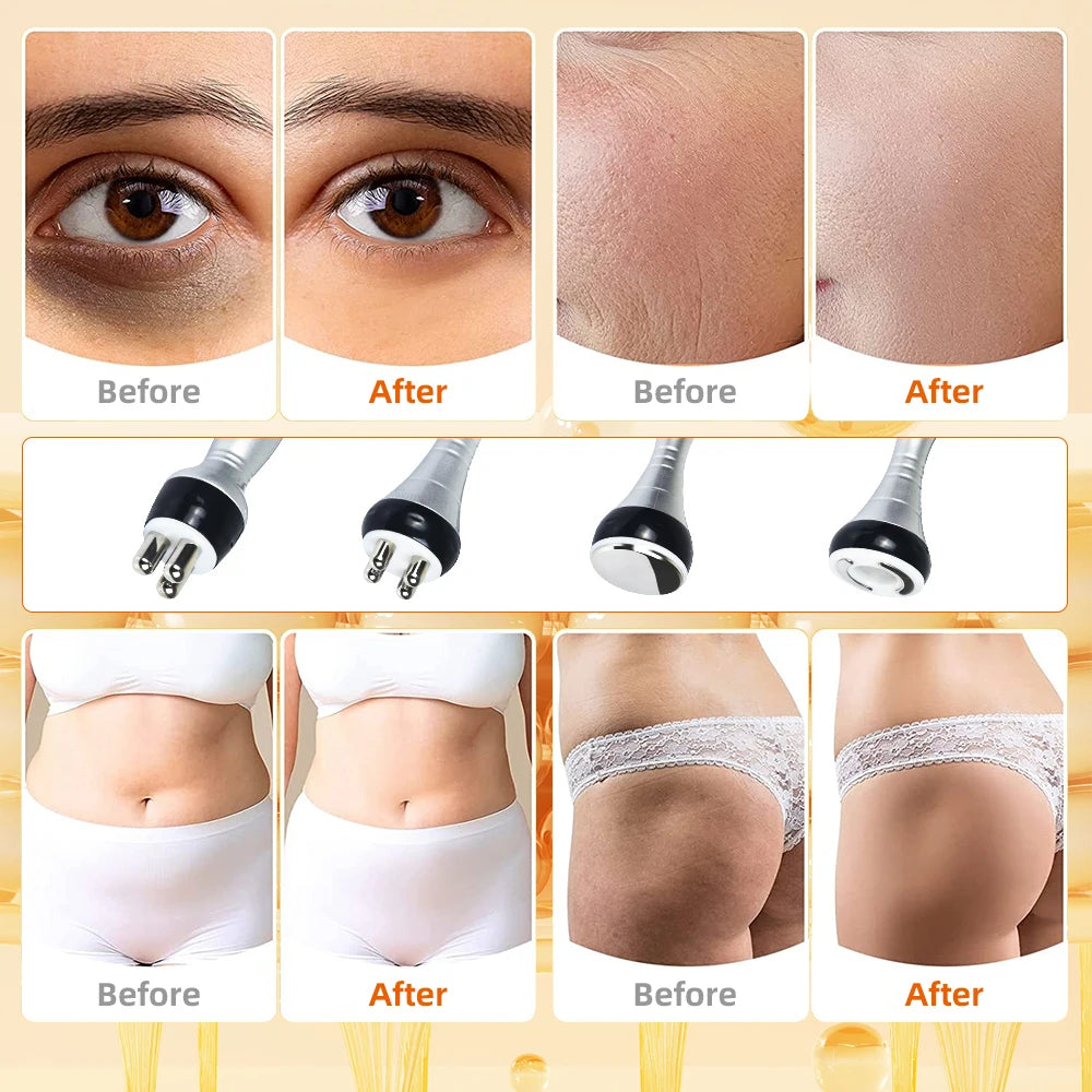 4 In 140K Cavitation Ultrasonic Body Slimming Machine Beauty Device for Skin Tightening
